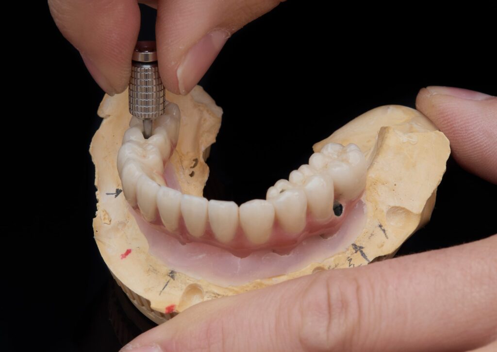 Implant Dentist